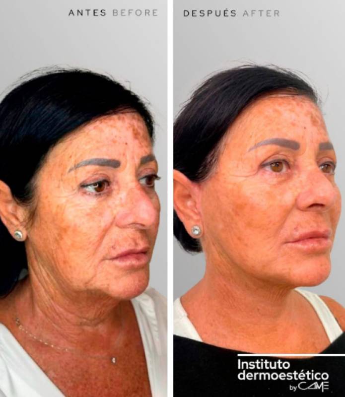 Expert cosmetic surgery consultations available this Saturday in Camposol